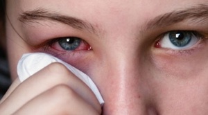 Показания для применения глазной гидрокортизоновой мази