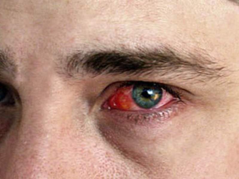 Разновидности заболевания глаз