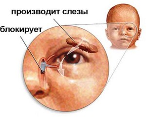 Проводимость слезного канала у ребенка - схема