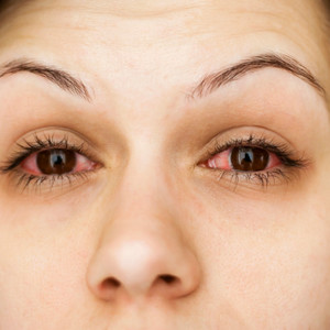 Симптомы ангиопатии сетчатки глаз