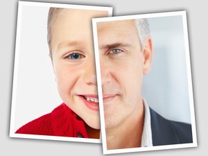 Причиной возникновения факосклероза могут быть возрастные изменения хрусталика глаза