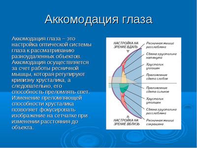 Спазм аккомодации картинки