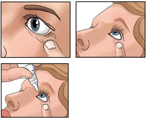 Как правильно закапывать глазные капли
