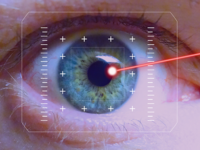 Описание лазерной коррекции зрения глаз