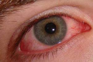 Самыне популярные препараты для лечения глаз