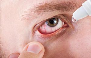 Особенности лечения глаз каплями Вигамокс