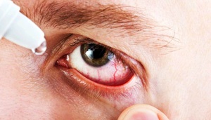 Особенности применения глазных капель Полинадим для лечения глаз