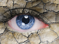 Какие средства помогают бороться с синдромом сухого глаза