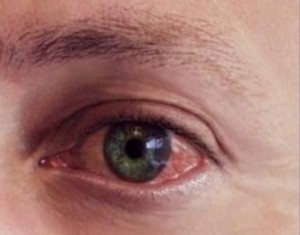 Заболевание глаз у взрослых