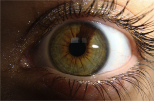Ярко янтарные глаза